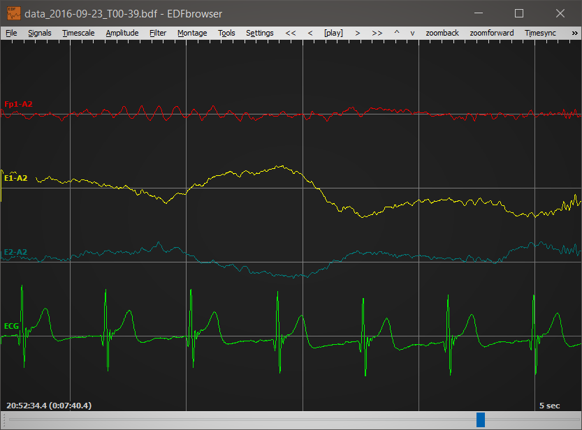 EDF, Hackaday