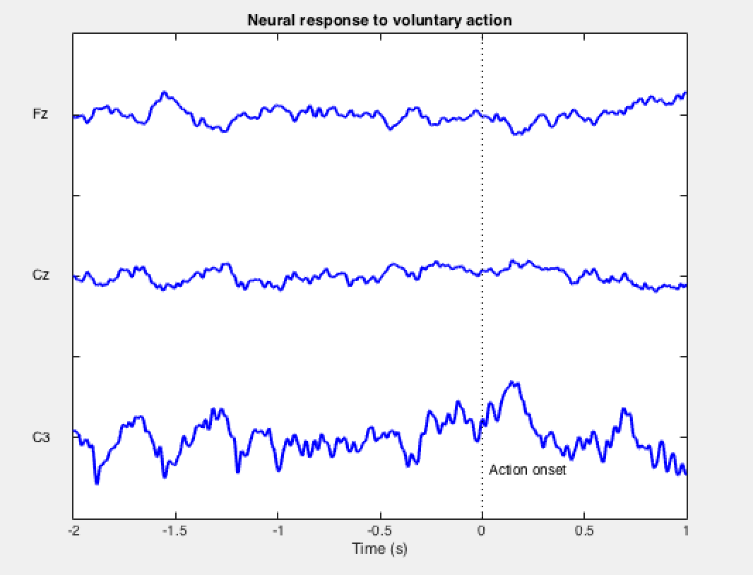 [Summer’16 Internship] Arduino, EEG, and Free Will: Three Channels!