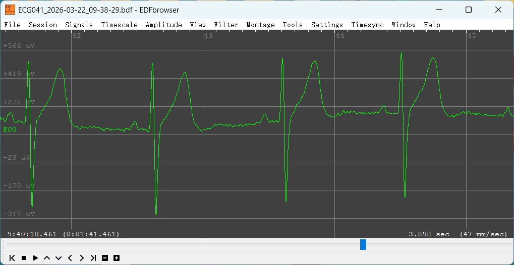Gallery | DIY ECG With Discrete Analog Front End | Hackaday.io