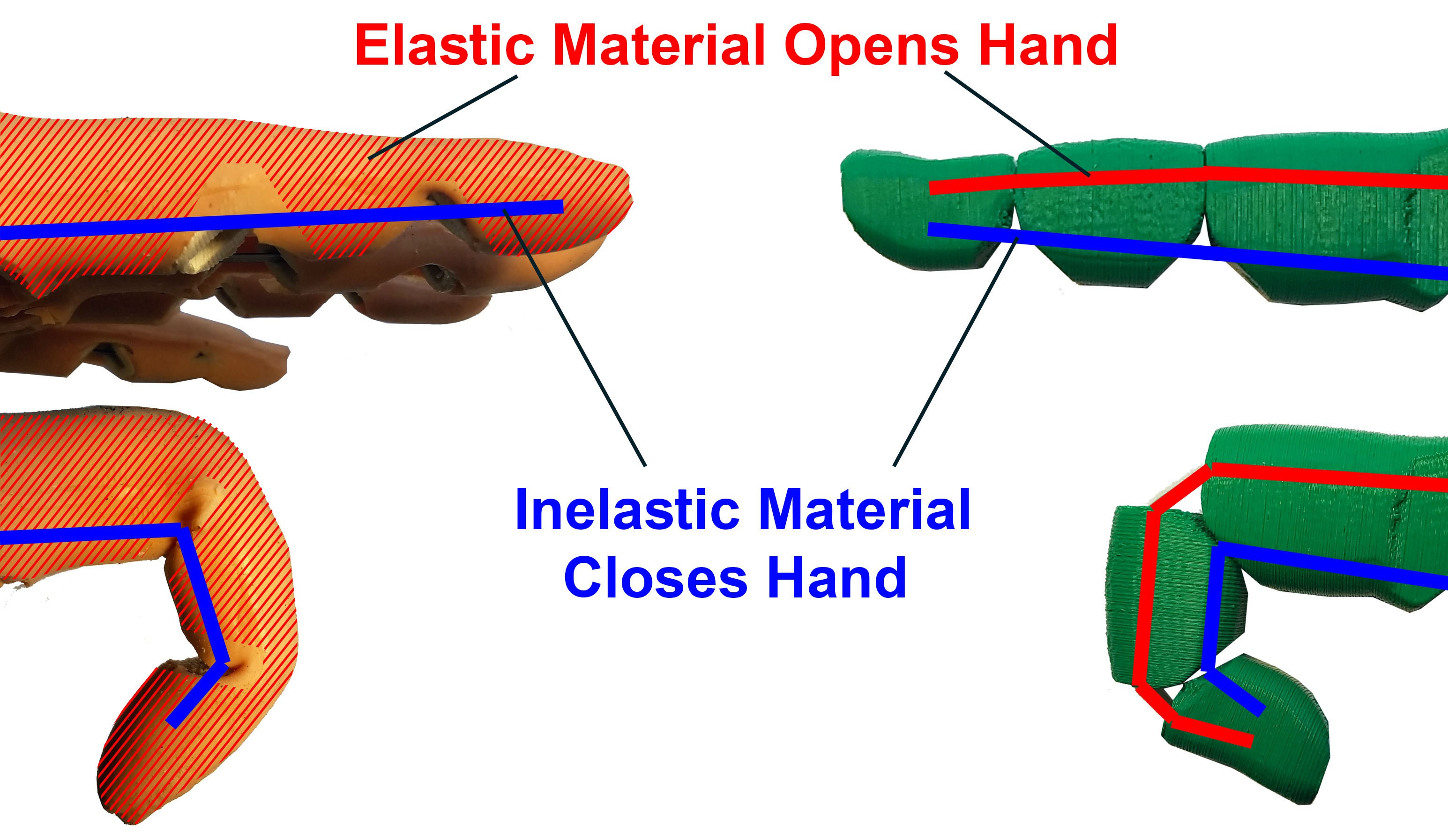 3D Printed Prosthetic Hands