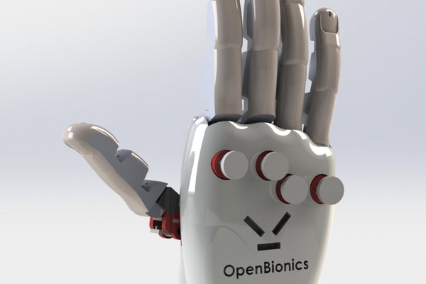 OpenBionics Affordable Prosthetic Hands 