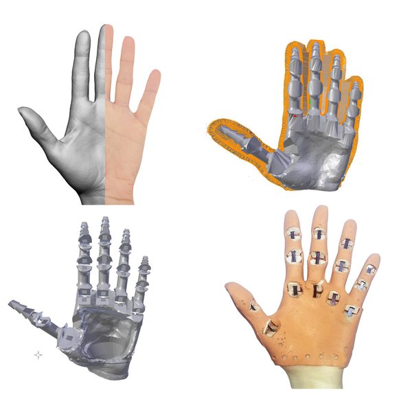 3D Printed Prosthetic Hand Stl  - Sldas 3Ds Fbx Obj Wrl Stl.