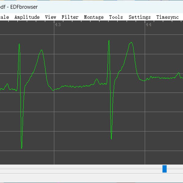 DIY ECG With Discrete Analog Front End | Hackaday.io