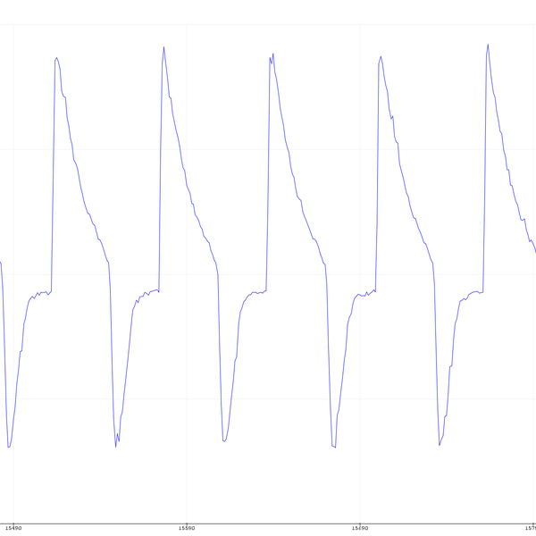 Open Source Spirometer using ESP32 | Hackaday.io